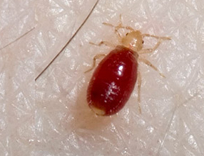 Bed bug on human skin with body full of blood.