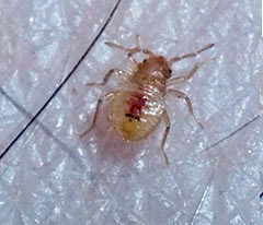Bed bug on human skin before biting. The bug's body is clear with a speck of red in the center.