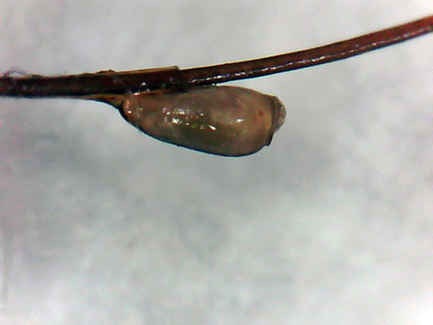 Louse egg (nit) on a strand of hair.