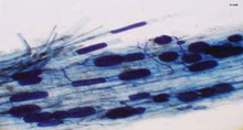 Endotrophic mycorrhiza 