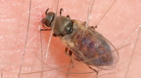 Black fly on a person's skin.
